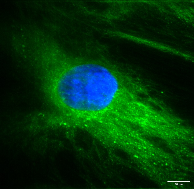 BPAE cells #2, SIMSCOP L series, 60X objective lens NA 1.2